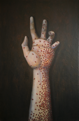 Beautiful Infection